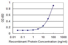 TBX21 / T-bet Antibody (clone 1F4)