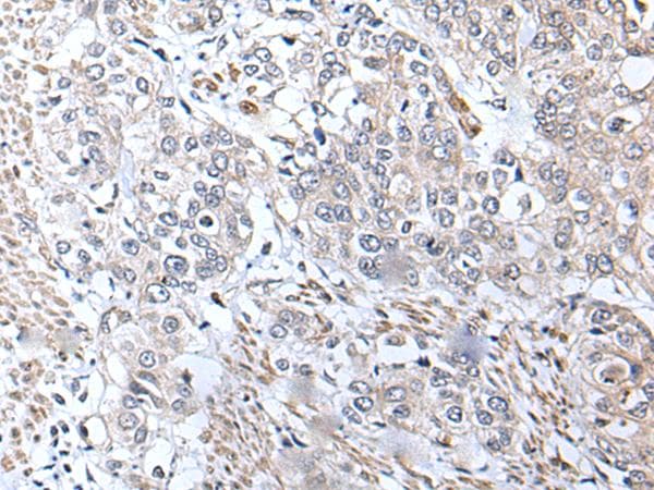 Polyclonal Rabbit anti-Human METTL7A Antibody (IHC)