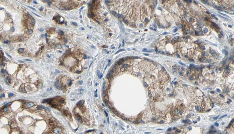 ABCC4 / MRP4 Antibody