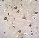 ZNF665 Antibody (aa70-99)
