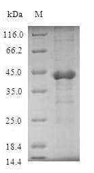 Human UBE2D4 Protein (Recombinant GST, N-terminus)