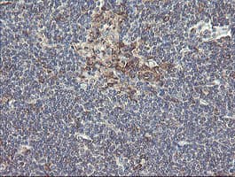 UBE2J1 Antibody (clone OTI3D1)