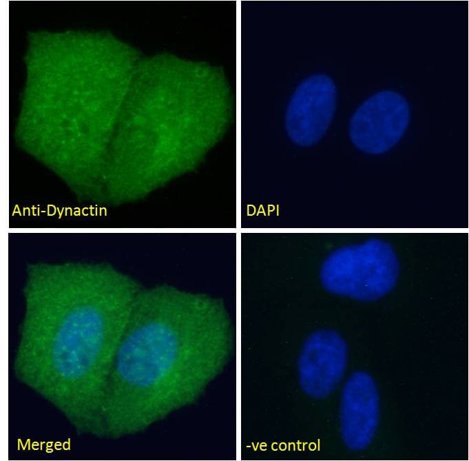 IHC-plus™ Polyclonal Goat anti-Human DCTN1 / Dynactin 1 Antibody (aa1266-1278, IHC, IF, WB)
