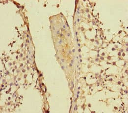 PPFIA1 / LIPRIN Antibody