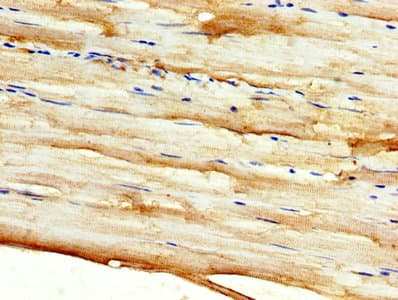 DKK2 Antibody (aa34-259)