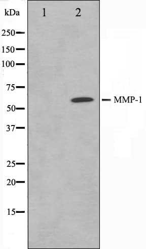 MMP1 Antibody