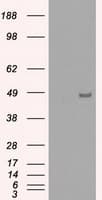 Monoclonal Mouse anti-Human IRF3 Antibody (clone OTI4D4, IHC, IF, WB)