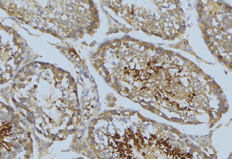 Polyclonal Rabbit anti-Human VASP Antibody (IHC, IF, WB)