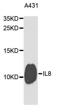 Polyclonal Rabbit anti-Human IL8 / Interleukin 8 Antibody (IHC, WB)