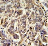 Polyclonal Rabbit anti-Human AAGAB Antibody (aa286-313, IHC, WB)