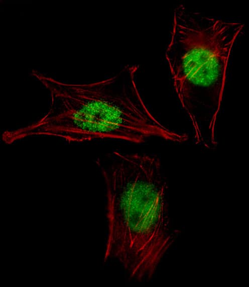 Polyclonal Rabbit anti-Human GAX / MEOX2 Antibody (aa164-192, IF, WB)