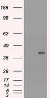 Monoclonal Mouse anti-Human KRT19 / CK19 / Cytokeratin 19 Antibody (clone OTI3A11, WB)
