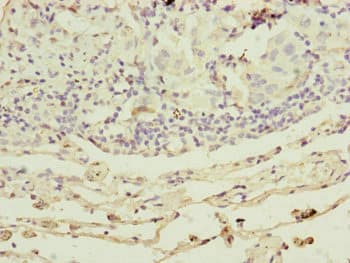RARS2 / ARGRS Antibody