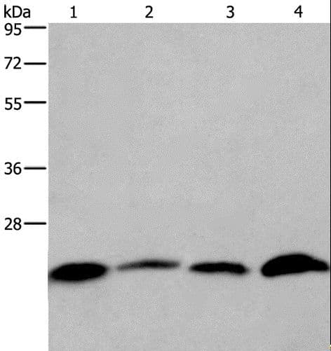 IHC-plus™ Polyclonal Rabbit anti-Human CMTM6 / CKLFSF6 Antibody (IHC, WB)
