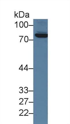F13A1 / Factor XIIIa Antibody (aa372-616)