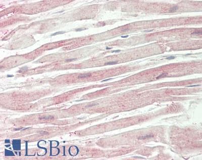 IHC-plus™ DKK3 Antibody