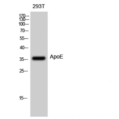 Polyclonal Rabbit anti-Human APOE / Apolipoprotein E Antibody (Internal, IHC, WB)