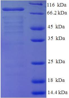 Chicken VTG1 / Vitellogenin 1 Protein (Recombinant His)