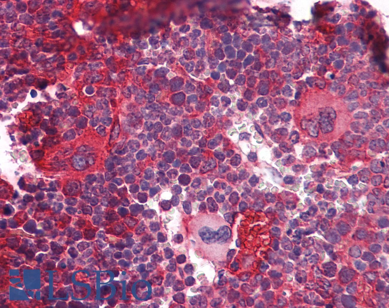 Polyclonal Rabbit anti-Mouse DNMT / DNMT1 Antibody (aa151-200, IHC, WB)