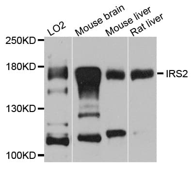 IHC-plus™ IRS2 / IRS-2 Antibody