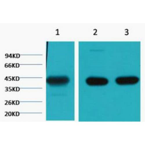 ACTA1 / Skeletal Muscle Actin Antibody (Internal, clone 4B11)