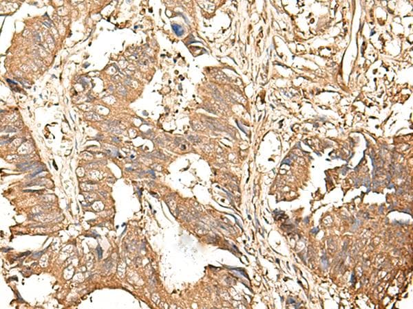Polyclonal Rabbit anti-Human GALR2 / Galanin Receptor 2 Antibody (IHC)