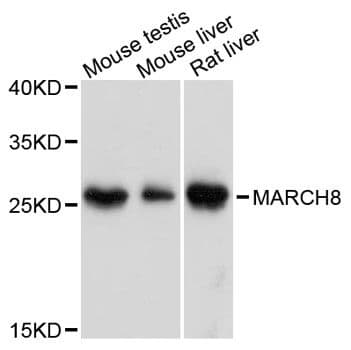 Polyclonal Rabbit anti-Human MARCH8 Antibody (WB)