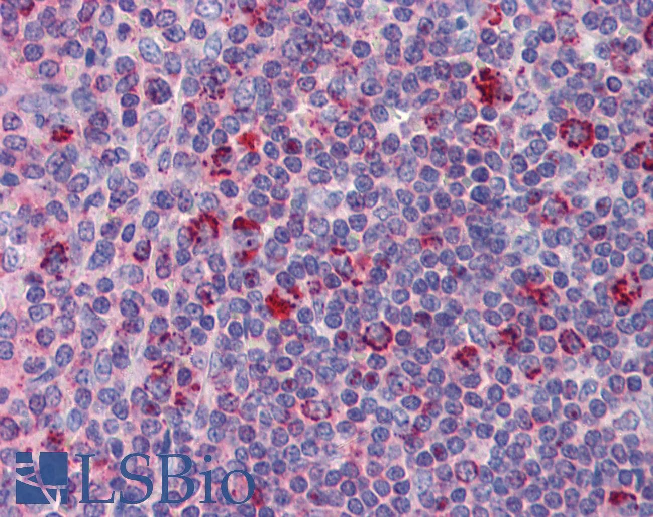 IHC-plus™ DAP12 Antibody