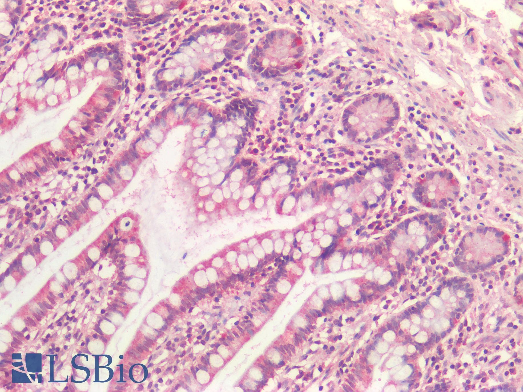 PathPlus™ Polyclonal Goat anti-Human SDHB Antibody (aa271-280, IHC, WB)