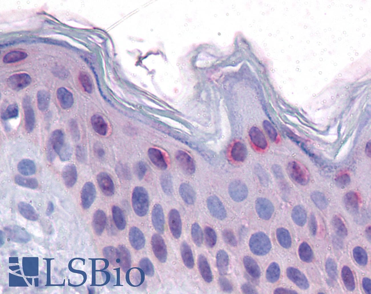 Polyclonal Rabbit anti-Human TP53 / p53 Antibody (N-Terminus, IHC, WB)