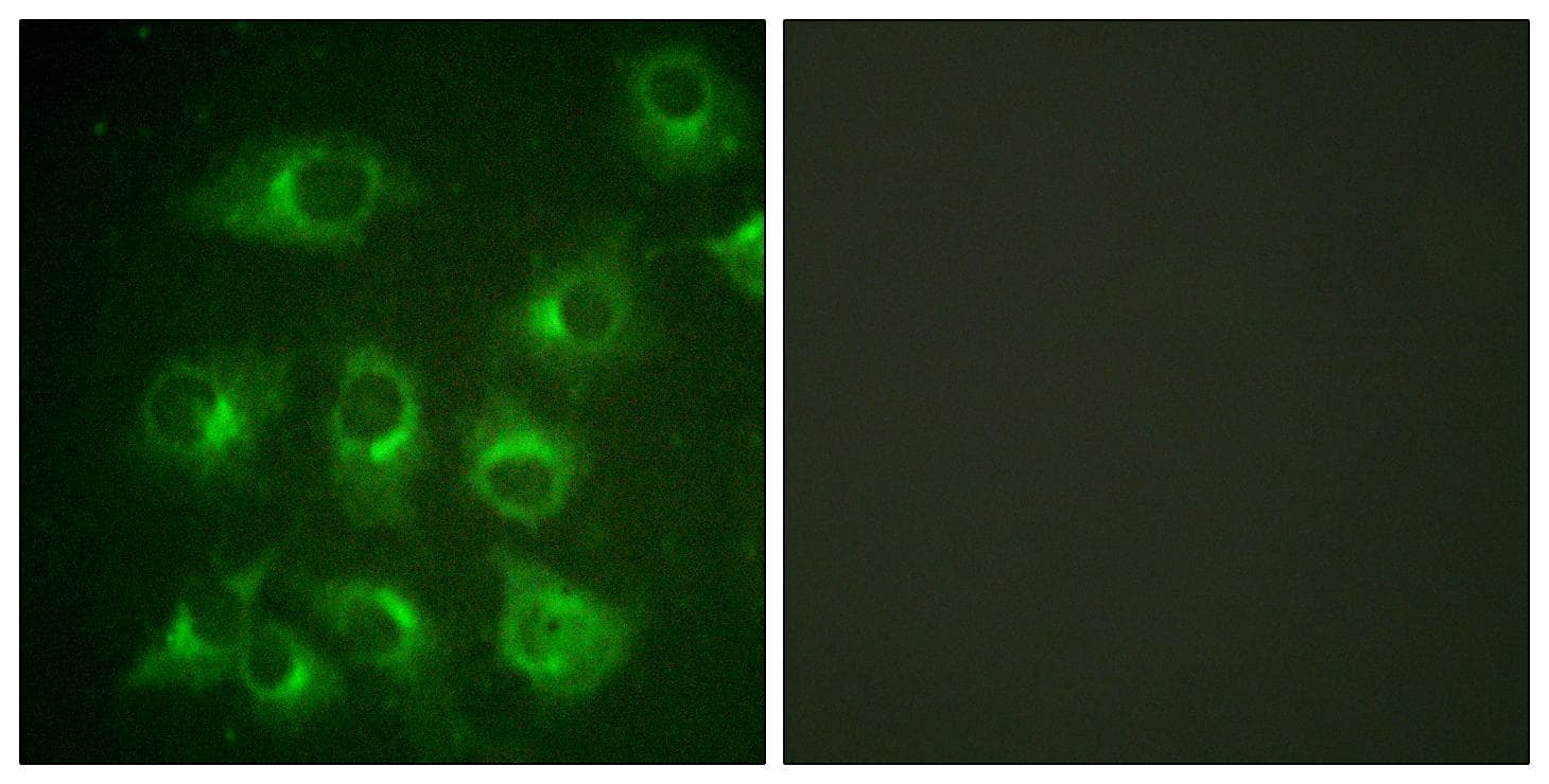 CRK Antibody (p221)