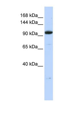 ZNF112 / ZFP112 Antibody (N-Terminus)