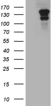 Monoclonal Mouse anti-Human CASKIN2 Antibody (clone OTI4A3, aa147-552, WB)