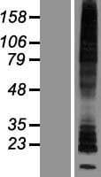 HRH2 / Histamine H2 Receptor Protein (Over-Expression Lysate Myc-DDK (Flag))