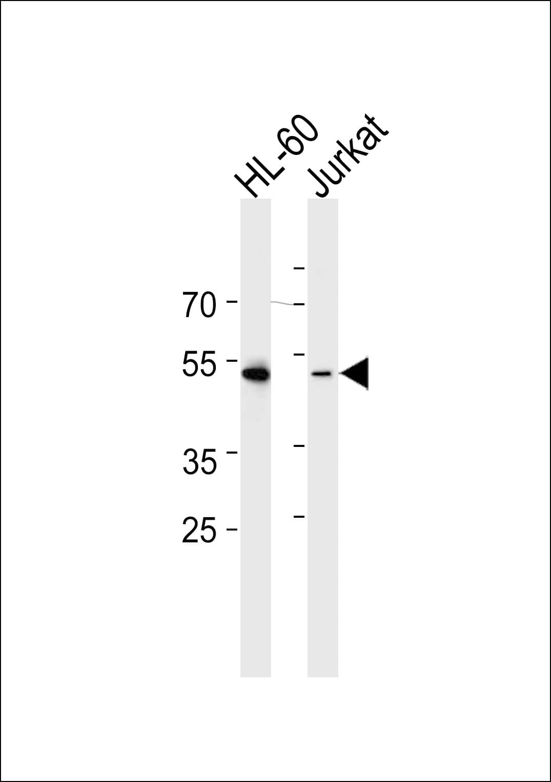 RUNX3 Antibody (aa168-197)