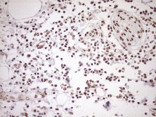 EXOSC1 / CSL4 Antibody (clone OTI1H9)