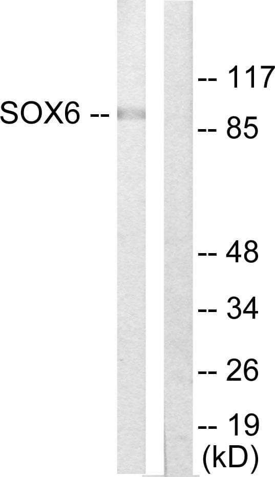 SOX6 Antibody