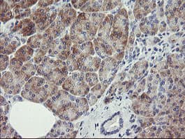 RIOK2 Antibody (aa277-552, clone OTI5D11, Carrier-free)
