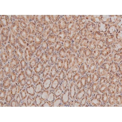 MAPT / Tau Antibody (phospho-Ser262)