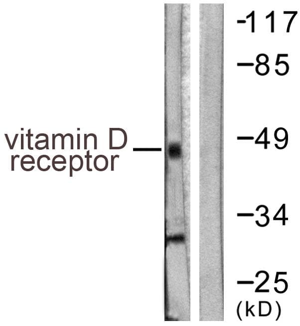 Vitamin D Receptor / VDR Antibody (p208)