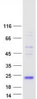 Human FSHB / FSH Beta Protein (Recombinant Myc-DDK (Flag))
