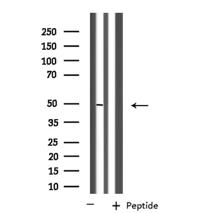 FNTB Antibody