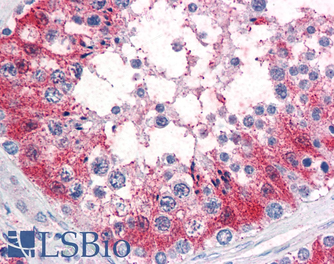 IHC-plus™ Polyclonal Rabbit anti-Human SRPX2 Antibody (Internal, IHC)