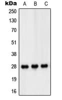 PEX11B Antibody (Internal)