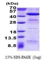 Human ACAA2 Protein (Recombinant His)