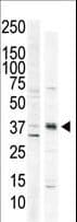 Polyclonal Rabbit anti-Human CAMK1 / CAMKI Antibody (aa341-370, IHC, WB)
