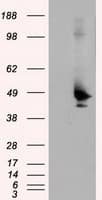 TLDC1 / KIAA1609 Antibody (clone OTI13H6)