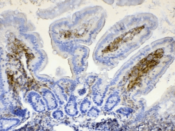 LYN Antibody