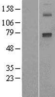CYP2E1 Protein (Over-Expression Lysate Myc-DDK (Flag))
