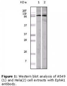 Monoclonal Mouse anti-Human EPHA1 / EPH Receptor A1 Antibody (clone 5D2D1, IHC, WB)